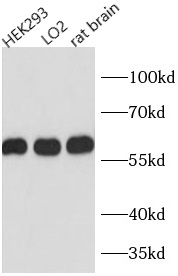      anti- PDI antibody