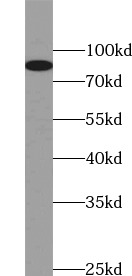      anti- Calnexin antibody