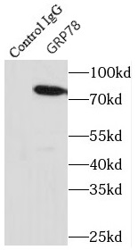 anti- GRP78/BIP antibody