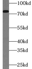 anti- GRP78/BIP antibody