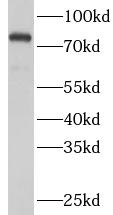      anti- HSPA5 antibody