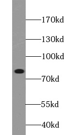 anti- GRP78/BIP antibody