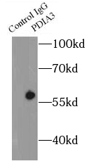      anti- ERp57/ERp60 antibody