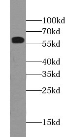     anti- ERp57/ERp60 antibody