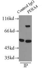      anti- ERp72 antibody