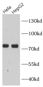 anti- ERp72 antibody