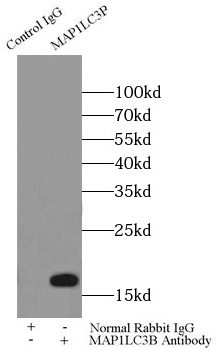      anti- LC3 antibody