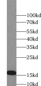      anti- LC3B-Specific antibody