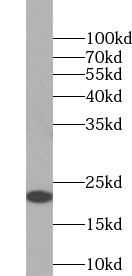      anti- CD3 epsilon antibody