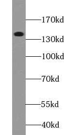  anti- NCAM1/CD56 antibody