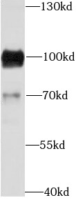     anti- CD19 antibody