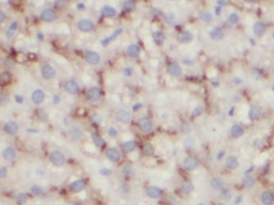      CD16抗体