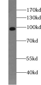  anti- CD68 antibody