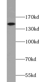 CD11B/Integrin alpha M抗体