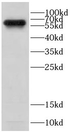      anti- CD80 antibody