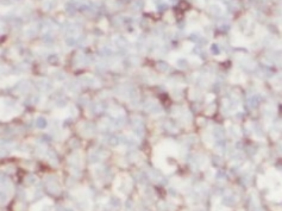      CD80抗体