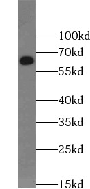       anti- CD80 antibody