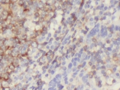      anti- CD86 antibody