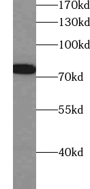      anti- CD86 antibody