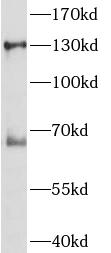 anti- iNOS antibody