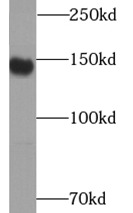     anti- CD163/M130 Antibody