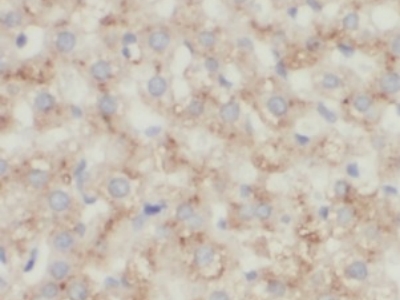      CD206抗体