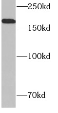     anti- CD206 antibody