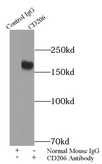 CD206抗体