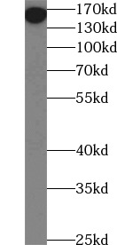 anti- CD206 antibody