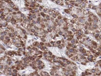      liver Arginase抗体