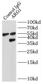      anti- liver Arginase antibody