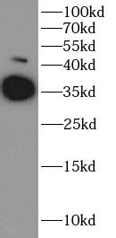     anti- liver Arginase antibody