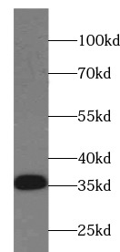     anti- liver Arginase antibody