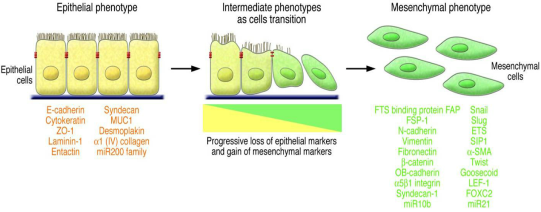 上皮间质转化过程