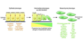 上皮间质转化(EMT)4种标志物介绍