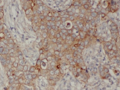     anti- E-cadherin antibody