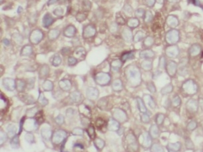 anti- E-cadherin antibody