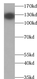 anti- N-cadherin antibody