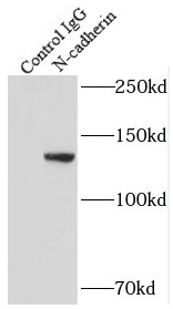 anti- N-cadherin antibody