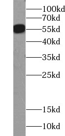     anti- Vimentin antibody