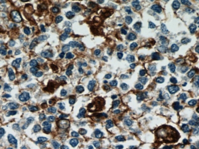     anti- Vimentin antibody