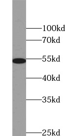 anti- Vimentin antibody