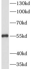 anti- Vimentin antibody