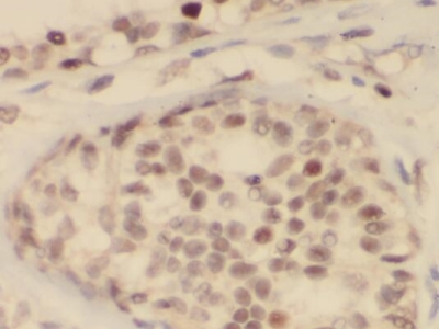    anti- PCNA antibody