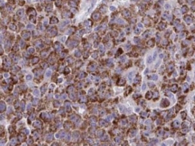      anti- alpha Tubulin antibody