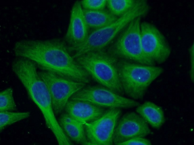      anti- Tubulin-beta antibody