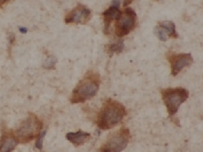      anti- Tubulin-beta antibody