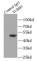      Tubulin-beta抗体