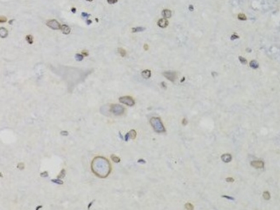     anti- Lamin B1 antibody